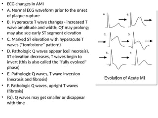 • ECG changes in AMI
• A. Normal ECG waveform prior to the onset
of plaque rupture
• B. Hyperacute T wave changes - increased T
wave amplitude and width; QT may prolong;
may also see early ST segment elevation
• C. Marked ST elevation with hyperacute T
waves (“tombstone” pattern)
• D. Pathologic Q waves appear (cell necrosis),
ST elevation decreases, T waves begin to
invert (this is also called the "fully evolved"
phase)
• E. Pathologic Q waves, T wave inversion
(necrosis and fibrosis)
• F. Pathologic Q waves, upright T waves
(fibrosis)
• (G). Q waves may get smaller or disappear
with time
 