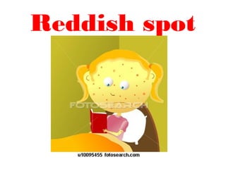 Reddish spot
 