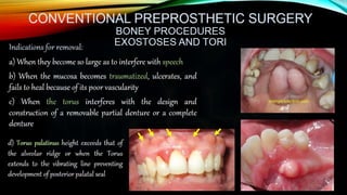 Improving the complete denture  foundation