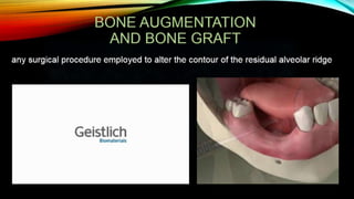 Improving the complete denture  foundation