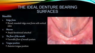 Improving the complete denture  foundation