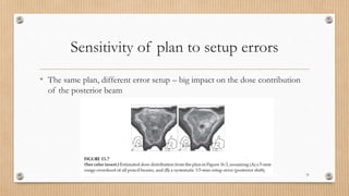 Sensitivity of plan to setup errors
• The same plan, different error setup – big impact on the dose contribution
of the posterior beam
31
 