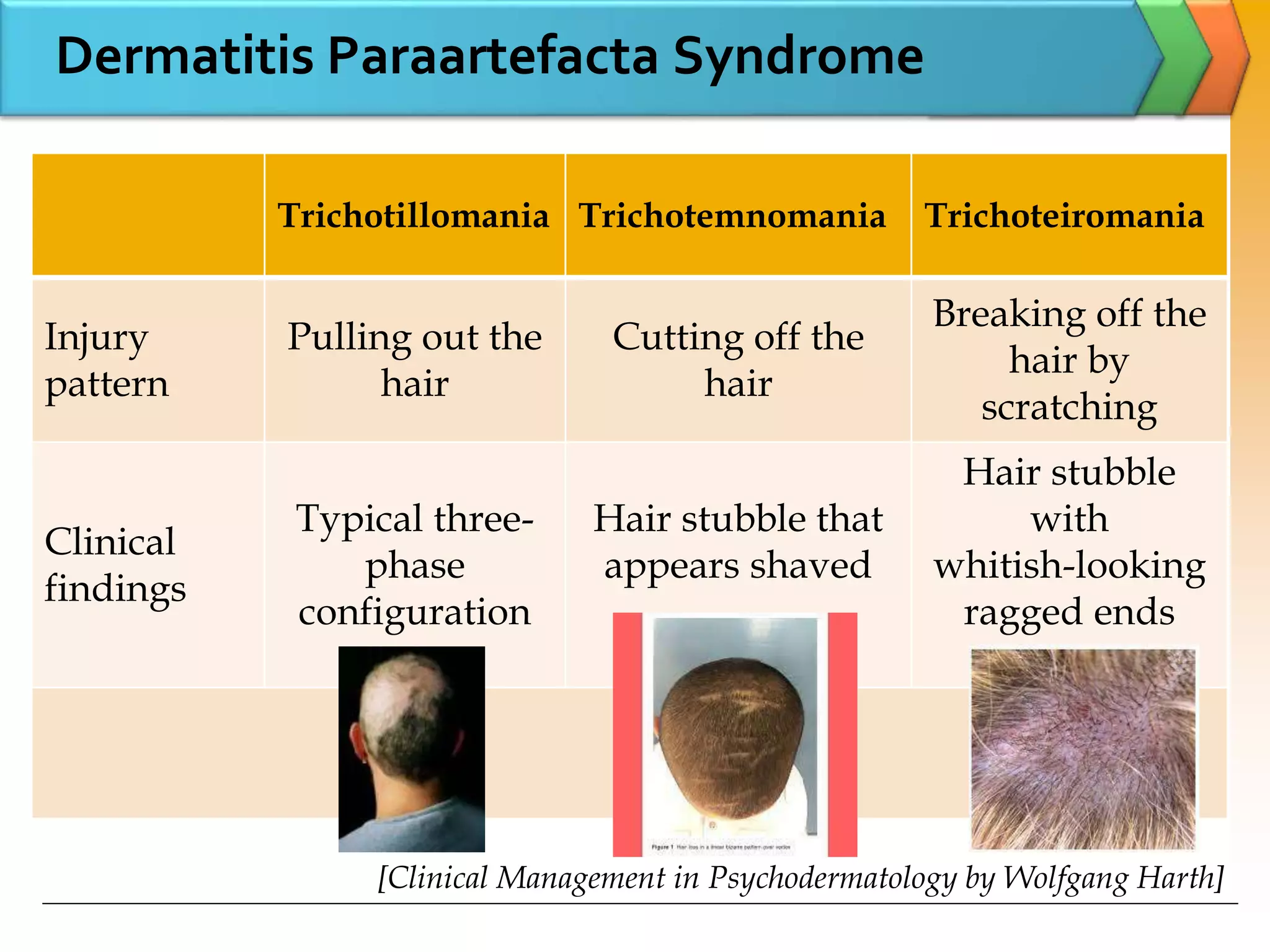 Trichotillomania Trichotemnomania Trichoteiromania
Injury
pattern
Pulling out the
hair
Cutting off the
hair
Breaking off the
hair by
scratching
Clinical
findings
Typical three-
phase
configuration
Hair stubble that
appears shaved
Hair stubble
with
whitish-looking
ragged ends
Dermatitis Paraartefacta Syndrome
[Clinical Management in Psychodermatology by Wolfgang Harth]
 