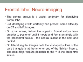 Frontal Lobe Anatomy And Clinical Relevance PPT frontal-lobe-anatomy-and-clinical-relevance-ppt