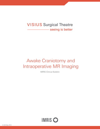 Awake Craniotomy and
Intraoperative MR Imaging
IMRIS Clinical Bulletin
14-024 May 2014
 