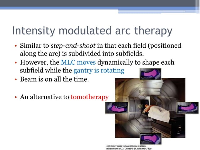 IMRT: Intensity Modulated Radiotherapy | PPT