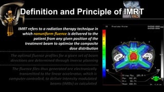 Definition and Principle of IMRT 
A breast cancer, metastatic to T7, previously treated with a full course of spinal radiation. The patient continued with severe pain in the thoracic spine and was referred for palliative radiation. She was to receive 18 Gy in nine fractions to the target volume shown on the above. The delivered dose distribution is shown to the below. Note the achievement of a concave high-dose volume and protection of the spinal cord. (From Carol 1997a.) 
 