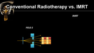 Benefits to the Patient 
Better normal tissue sparing – Less toxicity 
Possibly higher dose to the target – Higher chance of cure 
More dose in a fraction – Fewer fractions  
