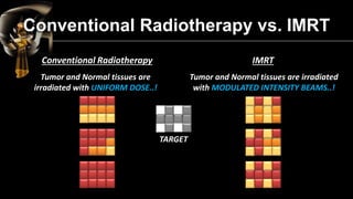 Intensity Modulated Radiation Therapy (IMRT) | PDF