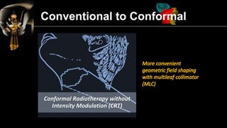 Intensity Modulated Radiation Therapy (IMRT) | PDF