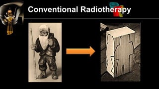 Conformal Radiotherapy  