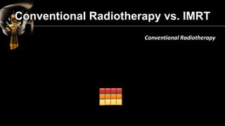 IMRT 
Conventional Radiotherapy vs. IMRT  