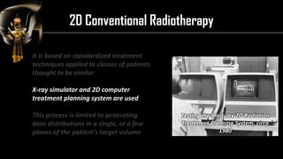 Intensity Modulated Radiation Therapy (IMRT) | PDF