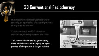 Intensity Modulated Radiation Therapy (IMRT) | PDF