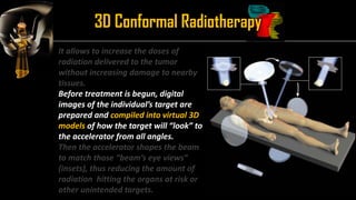 Intensity Modulated Radiation Therapy (IMRT) | PDF