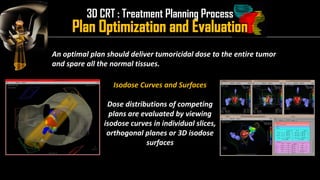 Intensity Modulated Radiation Therapy (IMRT) | PDF