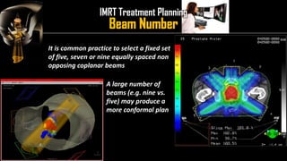 Intensity Modulated Radiation Therapy (IMRT) | PDF