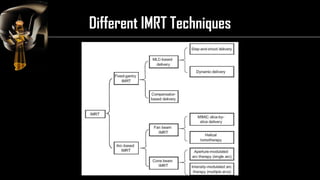 Intensity Modulated Radiation Therapy (IMRT) | PDF