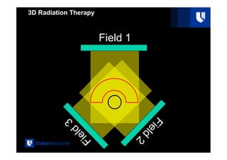 Intensity Modulated Radiation Therapy: Delivery Types .pdf