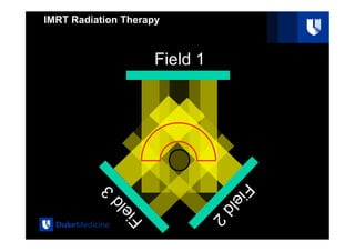 Intensity Modulated Radiation Therapy: Delivery Types .pdf