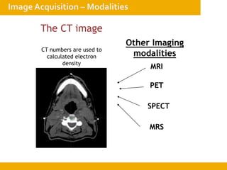The CT image
CT numbers are used to
calculated electron
density
Other Imaging
modalities
MRI
PET
SPECT
MRS
 