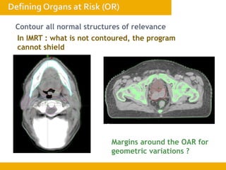 Contour all normal structures of relevance
In IMRT : what is not contoured, the program
cannot shield
Margins around the OAR for
geometric variations ?
 