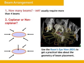 1. How many beams? – IMRT usually require more
than 4 beams
2. Coplanar or Non-
coplanar?
Use the Room’s Eye View (REV) to
get a practical idea about the
geometry of beam placement.
 