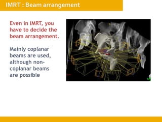 Even in IMRT, you
have to decide the
beam arrangement.
Mainly coplanar
beams are used,
although non-
coplanar beams
are possible
 