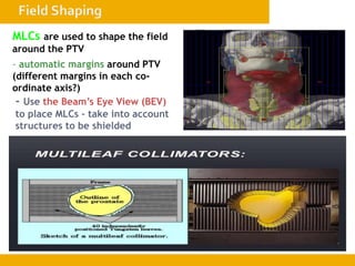 - automatic margins around PTV
(different margins in each co-
ordinate axis?)
MLCs are used to shape the field
around the PTV
- Use the Beam’s Eye View (BEV)
to place MLCs – take into account
structures to be shielded
 