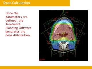 Once the
parameters are
defined, the
Treatment
Planning Software
generates the
dose distribution.
 