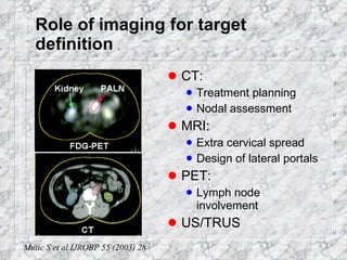 Role of imaging for target definition CT: Treatment planning Nodal assessment MRI: Extra cervical spread Design of lateral portals PET: Lymph node involvement US/TRUS Mutic S et al IJROBP 55 (2003) 28 