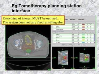 Eg Tomotherapy planning station interface Everything of interest MUST be outlined… The system does not care about anything else. 