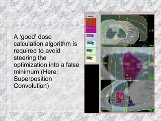 A ‘good’ dose calculation algorithm is required to avoid steering the optimization into a false minimum (Here: Superposition Convolution) 