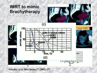 IMRT to mimic Brachytherapy HDR brachy 7 field IMRT HDR brachy 7 field IMRT Schefter et al. Med Dosim 27 (2002) 177 