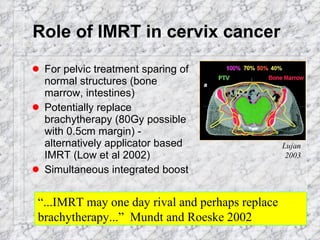 Role of IMRT in cervix cancer For pelvic treatment sparing of normal structures (bone marrow, intestines) Potentially replace brachytherapy (80Gy possible with 0.5cm margin) - alternatively applicator based IMRT (Low et al 2002)  Simultaneous integrated boost Lujan 2003 “ ...IMRT may one day rival and perhaps replace brachytherapy...”  Mundt and Roeske 2002 
