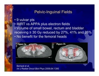 Imrt In Gynecologic Malignancies