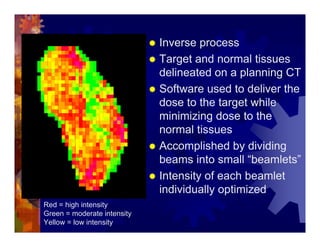 Imrt In Gynecologic Malignancies