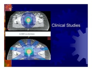 Imrt In Gynecologic Malignancies