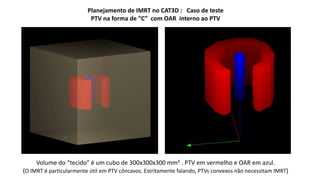 Planejamento de IMRT no CAT3D : Caso de teste 
PTV na forma de “C” com OAR interno ao PTV 
Volume do “tecido” é um cubo de 300x300x300 mm3 . PTV em vermelho e OAR em azul. 
(O IMRT é particularmente útil em PTV côncavos. Estritamente falando, PTVs convexos não necessitam IMRT) 
 