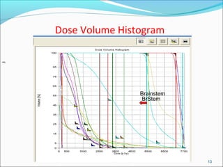 Dose Volume Histogram
13
Brainstem
BrStem
 