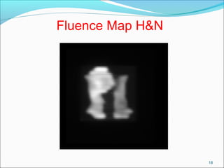18
Fluence Map H&N
 