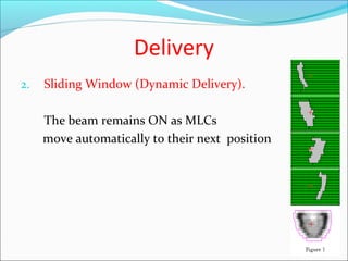 Delivery
2. Sliding Window (Dynamic Delivery).
The beam remains ON as MLCs
move automatically to their next position
29
 