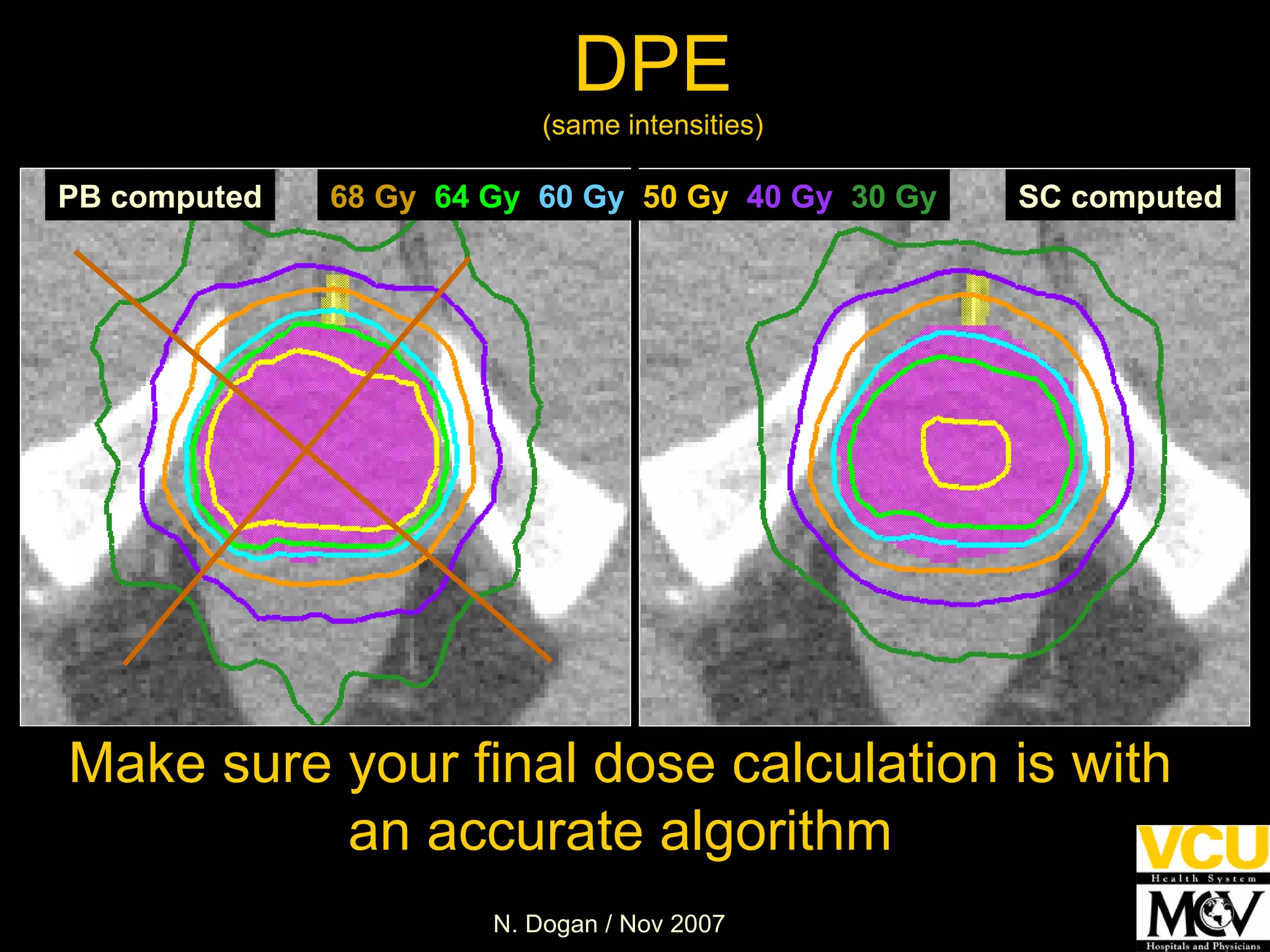 DPE (same intensities) PB computed SC computed Make sure your final dose calculation is with an accurate algorithm 68 Gy   64 Gy   60 Gy   50 Gy   40 Gy   30 Gy 