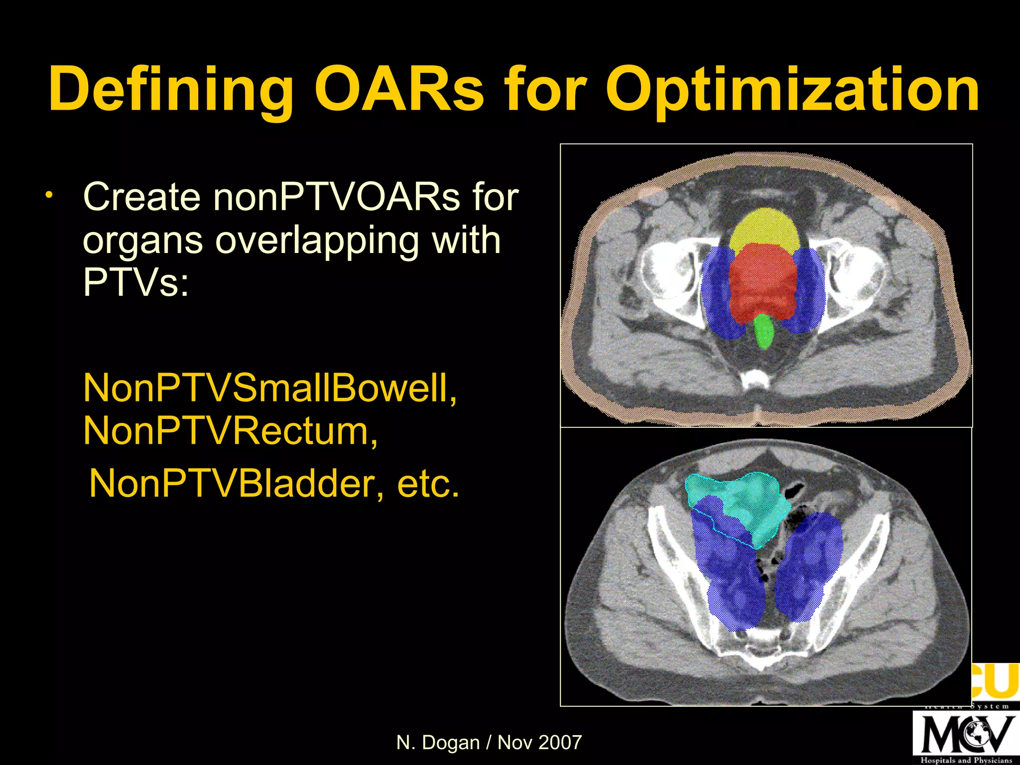Defining OARs for Optimization Create nonPTVOARs for organs overlapping with PTVs:  NonPTVSmallBowell, NonPTVRectum,  NonPTVBladder, etc.  
