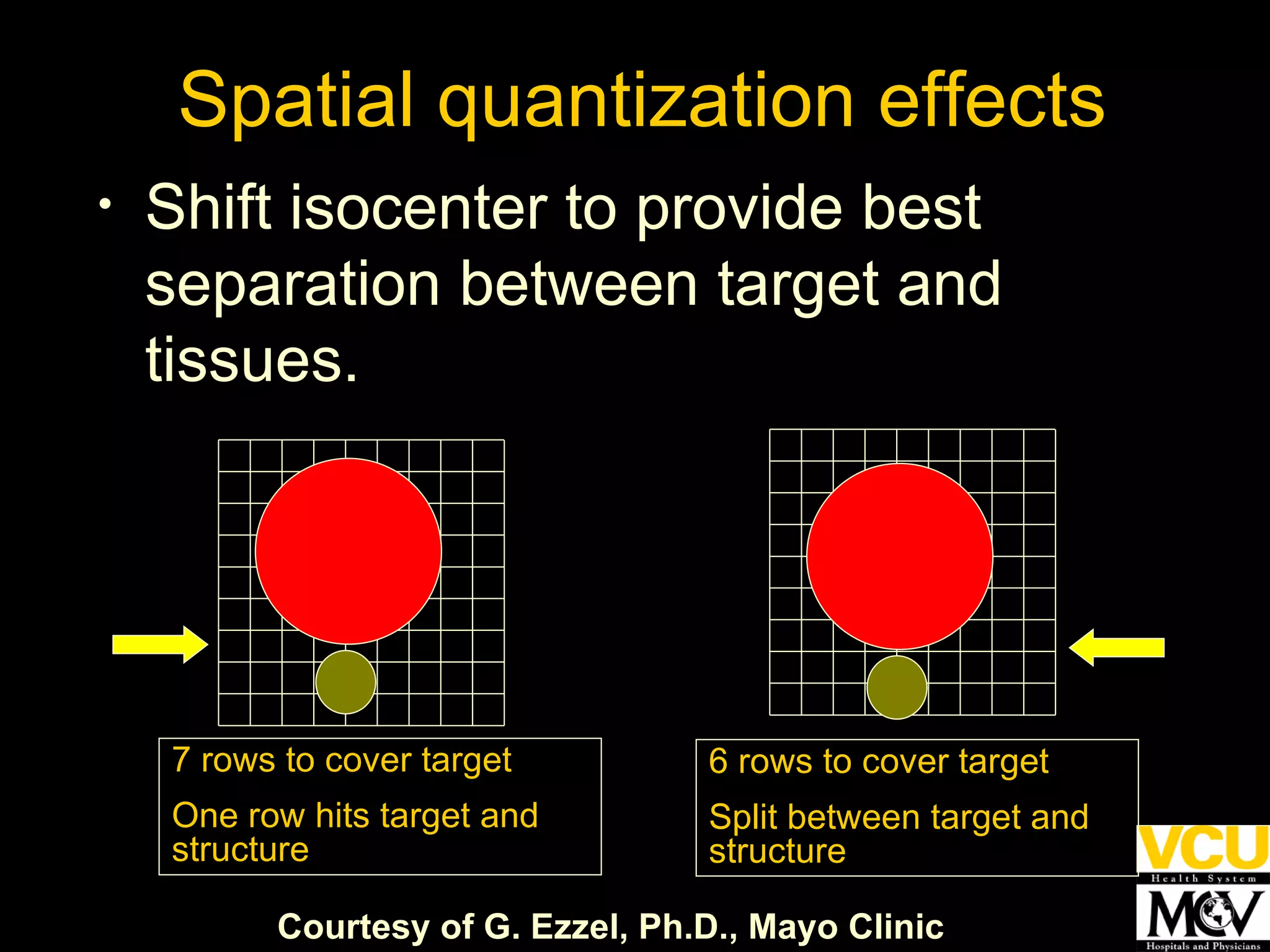Spatial quantization effects Shift isocenter to provide best separation between target and tissues. Courtesy of G. Ezzel, Ph.D., Mayo Clinic 7 rows to cover target One row hits target and structure 6 rows to cover target Split between target and structure 