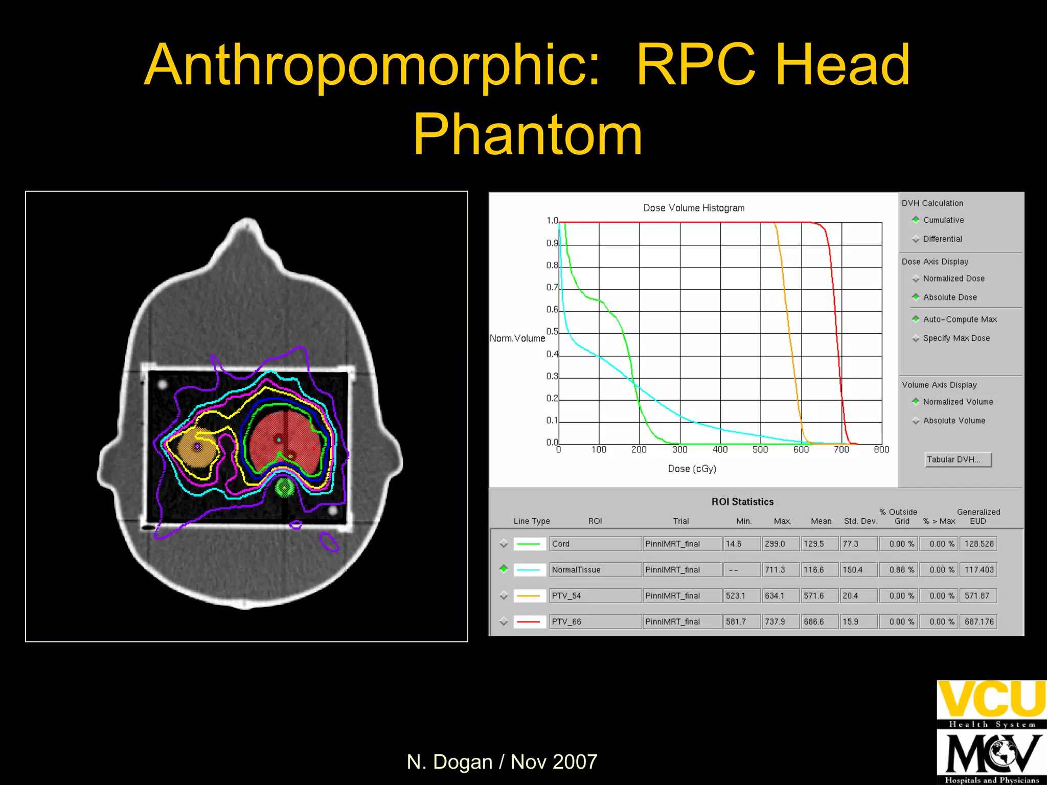 Anthropomorphic:  RPC Head Phantom 