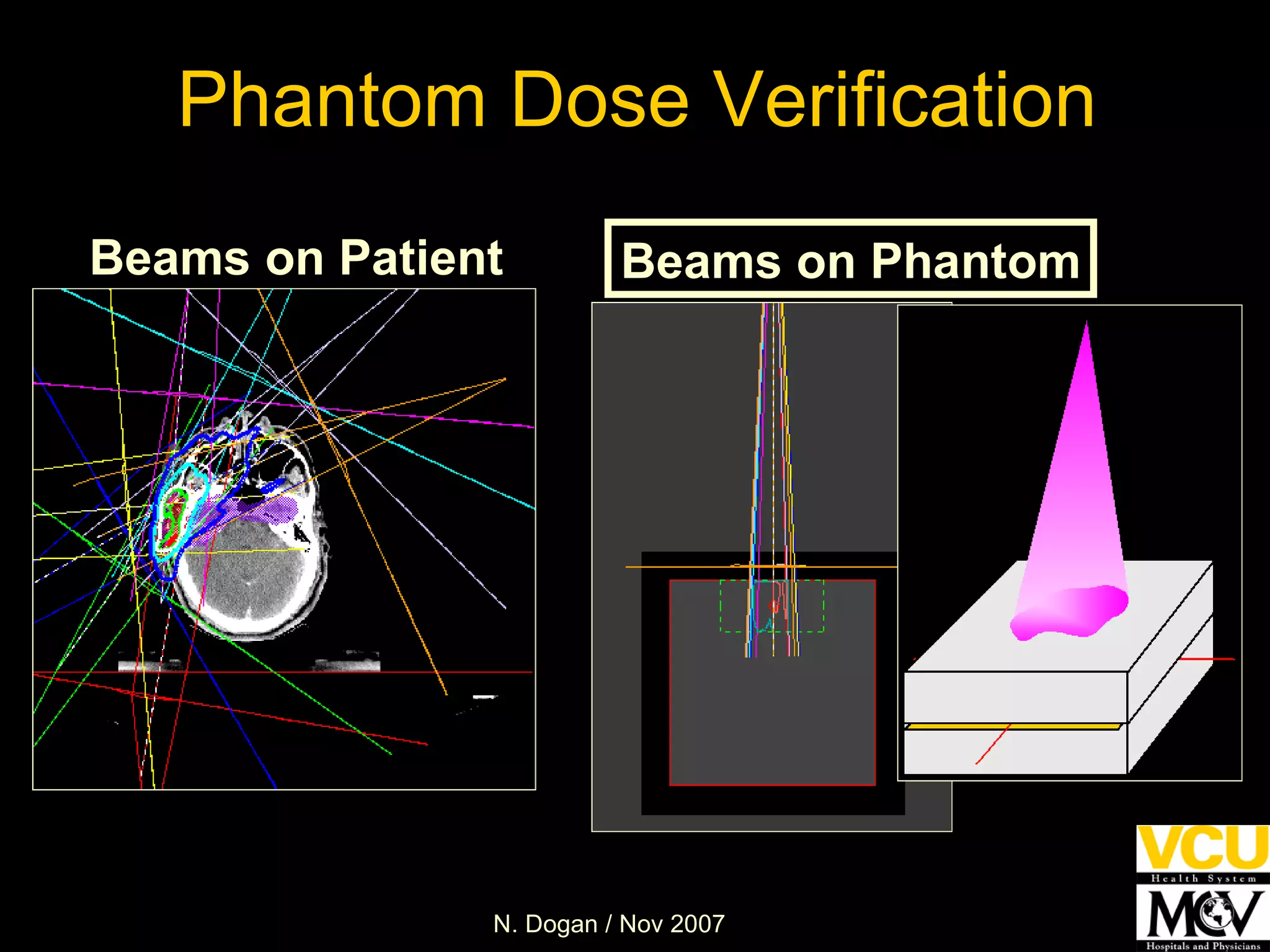 Phantom Dose Verification Beams on Patient Beams on Phantom 