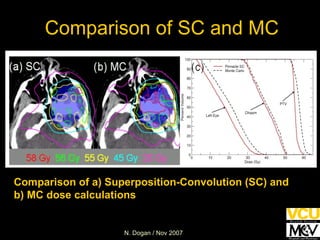 Comparison of SC and MC Comparison of a) Superposition-Convolution (SC) and b) MC dose calculations 