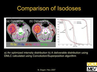 Comparison of Isodoses a) An optimized intensity distribution b) A deliverable distribution using DMLC calculated using Convolution/Superposition algorithm 