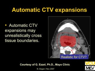 Realistic for CTV? Courtesy of G. Ezzel, Ph.D., Mayo Clinic Automatic CTV expansions may unrealistically cross tissue boundaries. Automatic CTV expansions 